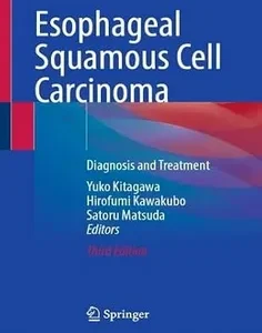 Esophageal Squamous Cell Carcinoma: Diagnosis and Treatment