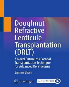 Doughnut Refractive Lenticule Transplantation (DRLT): A Novel Sutureless Corneal Transplantation Technique for Advanced Keratoconus