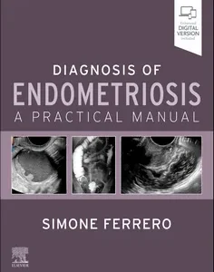 Diagnosis of Endometriosis
