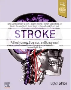 Stroke: Pathophysiology, Diagnosis, and Management