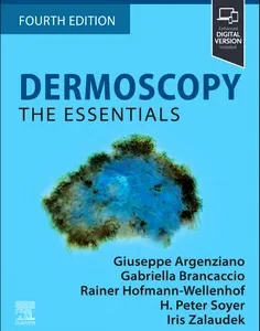 Dermoscopy: The Essentials