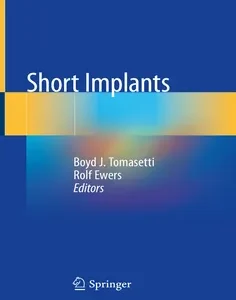 Short Implants