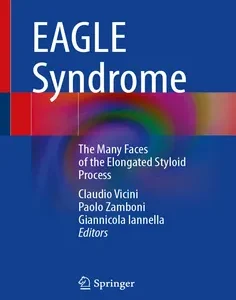 EAGLE Syndrome: The Many Faces of the Elongated Styloid Process