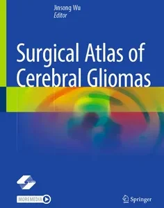 Surgical Atlas of Cerebral Gliomas